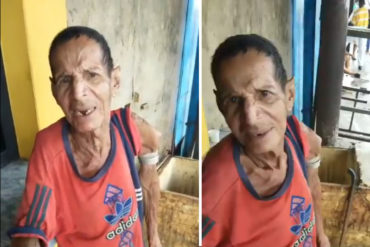 ¡QUÉ FUERTE! Abuelo quedó con el brazo fracturado y “guindando” tras caerse de una perrera (+Video doloroso)