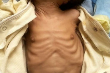 ¡TERRIBLE! Solicitan ayuda urgente para asistir a una bebé con evidente estado de desnutrición