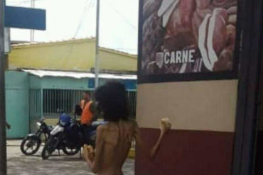 ¡PASA EN VENEZUELA! Las impactantes fotos de una mujer en extrema pobreza y sin ropa que te harán llorar