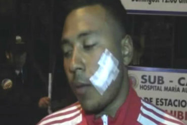 ¡QUÉ VIOLENCIA! Un colector le cortó el rostro a un venezolano en Perú (intentaba vender productos en la camioneta) (+Video)