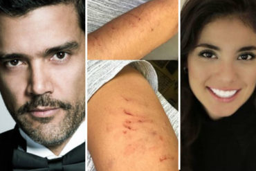 ¡PICA Y SE EXTIENDE! Actor que presuntamente golpeó a la actriz colombiana publica imágenes de supuestas agresiones