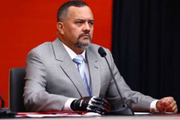 ¡MÍRALO! El precio nada socialista de la mano biónica que usa el hermano de Diosdado Cabello (impagable con los bonos) (+Video) ¡MÍRALO! El precio nada socialista de la mano biónica que usa el hermano de Diosdado Cabello (impagable con los bonos) (+Video)