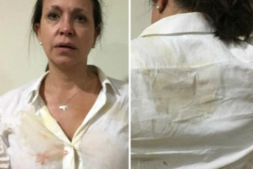 ¡FUERTES! Las primeras imágenes de María Corina Machado tras el ataque de colectivos en Upata: Rostro golpeado y sangre en su ropa