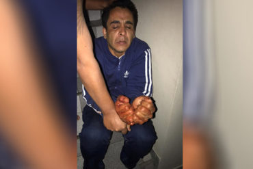 ¡DESGRACIA! Venezolano en Perú acuchilló a su mujer en el cuello en presencia de sus hijos (luego intentó suicidarse)