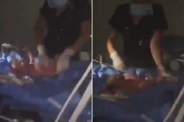 ¡DESGARRADOR! Médicos hacen lo imposible para salvar la vida de un recién nacido durante el apagón (+Video)