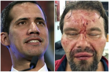 ¡INDIGNADO! Guaidó condenó agresion a periodista polaco: «Cómplices del terror y usurpación, la justicia comenzó y seguirá llegando»