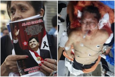 ¡IMPACTANTE! Revelan imágenes fuertes del expresidente Alan García luego de haberse disparado en la cabeza (+Fotos) (+Video)