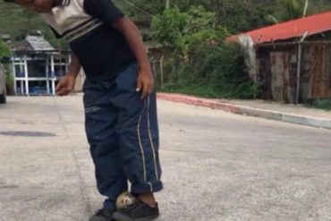 ¡QUÉ DOLOR! “Maduro nos tiene pasando hambre”: El testimonio de un niño en Carabobo (Dice que casi nunca desayuna, almuerza y cena)