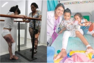 ¡IMPACTANTE! “Me devolvieron la pierna y la vida”, la conmovedora historia de una niña venezolana en Cúcuta