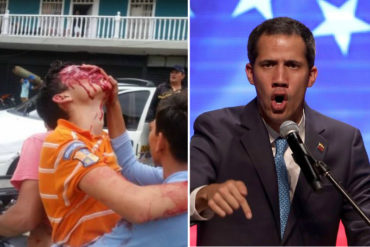 ¡SEPA! Guaidó condena el “sádico acto” en contra del joven que perdió sus ojos por un disparo de perdigón en la cara