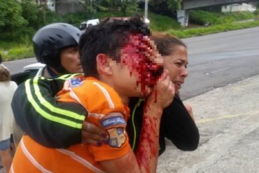 ¡TERRIBLE! Director de la Corporación de Salud del Táchira confirmó que Rufo Chacón perdió la vista por disparos de perdigón (+Video)