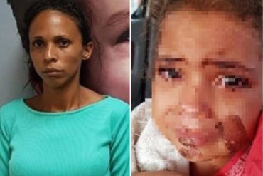 ¡INHUMANO! Detenida mujer por quemarles el rostro con una cuchara caliente a sus hijas de 4 y 6 años