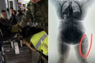 ¡VEA! Capturan en Colombia a una mujer que intentó viajar con 780 gramos de cocaína implantados en sus muslos (+Foto)