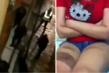 ¡DURO TESTIMONIO! Venezolana que recibió golpiza en Perú: Me exigieron que me fuera de su país, ladrona, me dijeron de todo” (+Video)