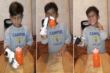 ¡VEA! La tierna reacción de un niño tachirense que toma agua con su prótesis por primera vez (+Video)