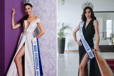 ¡MÍRELA! A la Miss Venezuela Thalía Olvino le llovieron críticas después de su últimas fotos por “detallitos” en sus pies y sandalias