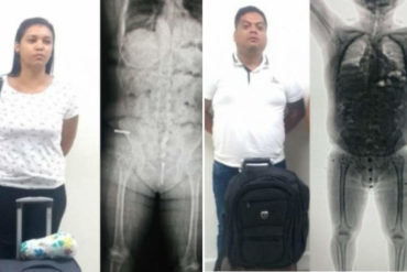 ¡SEPA! Descubren en Barranquilla a pareja venezolana con 57 cápsulas de cocaína en sus estómagos