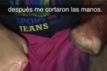 ¡ATROZ Y MUY DURO! El testimonio de un sargento sobreviviente de las minas en Bolívar: «Me cortaron la lengua y me dieron con un machete en la espalda» (+Video)