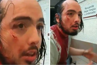 ¡GRAVE! Venezolano intentó detener a saqueadores en Chile y resultó herido (+Video)