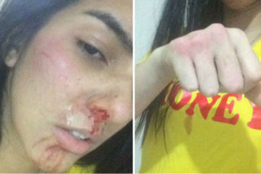 ¡QUÉ FUERTE! Joven relata cómo malandro la golpeó por no tener qué robarle: “Hoy pude haber muerto a coñ*zos” (+Fotos sensibles +Video)