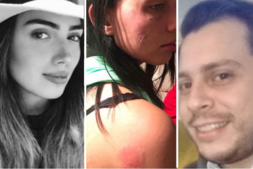 ¡GRAVE! Huyó de Venezuela tras ser víctima de violencia doméstica y ahora lo cuenta todo: Su pareja la golpeó, mordió e intentó asfixiar (+Fotos fuertes)