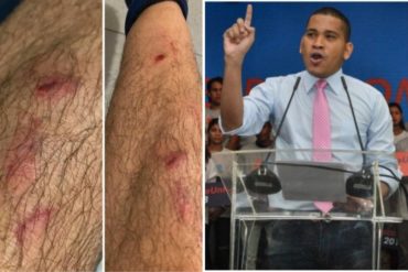 ¡SEPA! Leocenis García denuncia que fue agredido por la PNB en protesta en Chacao: Le rociaron gas pimienta (+Video y fotos)