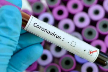 ¡SEPA! Min-Salud reveló que han hecho seguimiento a 93 personas que llegaron desde China a Venezuela: Ninguno ha presentado síntomas de coronavirus