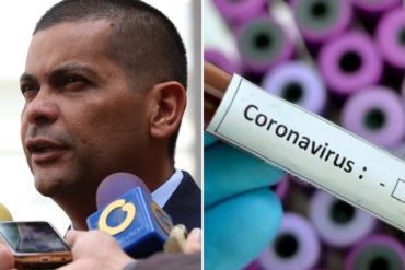 ¡LE DECIMOS! Gobernador del Zulia: Primer caso “altamente sospechoso” de coronavirus en la entidad es una mujer que estuvo en carnavales de Barranquilla