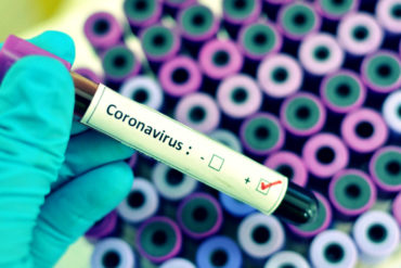 ¡TOME NOTA! ¿Cree que tiene el coronavirus? A continuación le decimos qué hacer y si debe o no acudir al hospital