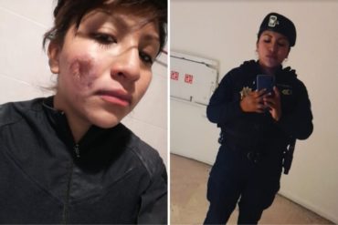 ¡QUÉ HORROR! “Feministas” quemaron el rostro de mujer policía: No he matado ni violado a nadie (+Foto)