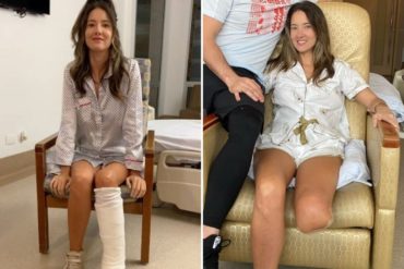 ¡SE LA CONTAMOS! La dura historia de la exmiss Colombia a la que debieron amputarle un pie por una complicación inusual tras una operación que lucía sencilla