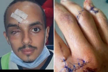 ¡ABRUMADOR! La terrible historia de un venezolano atacado por otros connacionales en su viaje de retorno al país (Perdió un ojo y le perforaron un pulmón)