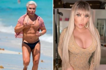 ¡MÍRELO! Así quedó el “ken humano” tras su transformación a mujer: buscaba tener las caderas de Kim Kardashian y los glúteos de JLo (+Fotos)