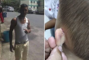 ¡ATENCIÓN! Buscan a un hombre que habría violado sexualmente, cortado, golpeado y quemado a su hijo de 3 años en Caracas (+Estremecedoras fotos)