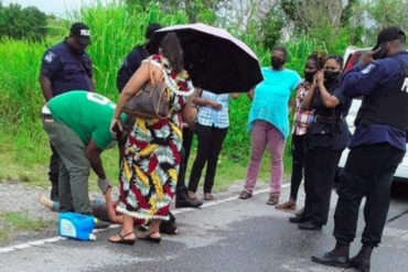 ¡TERRIBLE DESENLACE! Advierten que Stefany Flores podría perder uno de sus ojos tras brutal ataque del que fue víctima en Trinidad y Tobago