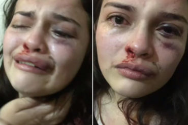 ¡TERRIBLE! El dramático video en el que joven denuncia que fue agredida salvajemente por su mamá y su padrastro: “Caí al piso casi inconsciente” (+Video fuerte)