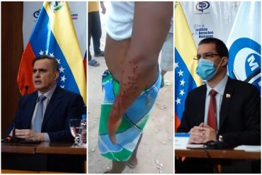 ¡DESCARADOS! Régimen sigue violando los DDHH en protestas pacíficas mientras promueve el «informe rojo» para lavarse la cara (+Video)