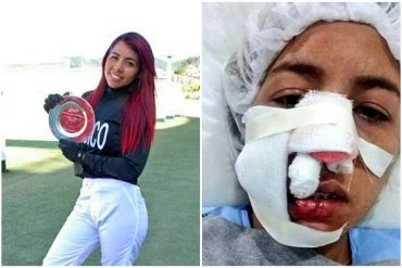 ¡QUÉ DESGRACIA! La jinete venezolana Cindy Carrero fue agredida salvajemente por antisociales que intentaron robar su auto (+Fotos fuertes)