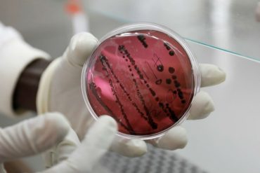 ¡ATENCIÓN! Un nuevo virus letal y similar al Ébola prende las alertas en América: ya hay un brote en Bolivia (+Posibles formas de contagio)