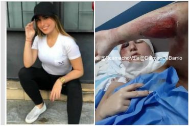 ¡TERRIBLE! Difunden desgarradoras imágenes de la joven Ingrid Gomes tras el brutal ataque de su exnovio (+Fotos sensibles)