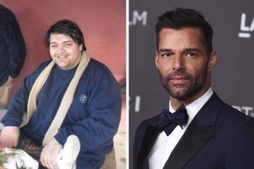 ¡SORPRENDENTE! La increíble transformación de un hombre con sobrepeso que se hizo 28 operaciones para lucir como Ricky Martin (+Fotos)