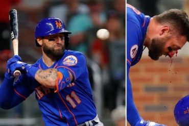 ¡VEA! El escalofriante pelotazo que recibió en su cara a 95 mph el jardinero de los Mets de Nueva York Kevin Pillar (+Video)