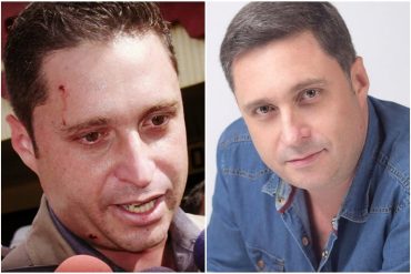 ¡LAMENTABLE! Falleció el periodista José Manuel Dopazo, quien estuvo al frente de Noticiero Venevisión: “Es un golpe al corazón” (+Reacciones +video)