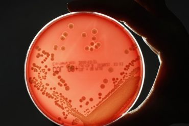 ¡TERRIBLE! Un hombre se contagió con una bacteria “comecarne” tras utilizar la afeitadora de su compañero