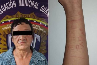 ¡DESGARRADOR! “Te odio, papá”: lo que una adolescente escribió en su brazo con una hojilla porque su padre la abusaba sexualmente (el Cicpc lo detuvo)