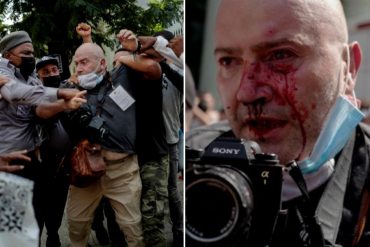 ¡LE CONTAMOS! Fuerzas represivas del régimen cubano agredieron salvajemente a un fotógrafo de la agencia AP (+Fotos)