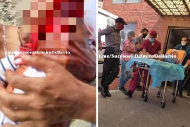 ¡DESGARRADOR! Un niño resultó herido durante los enfrentamientos en la Cota 905 este #8Jul (+Imágenes fuertes)