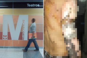 ¡GRAVE! Explosión en estación del Metro de Caracas dejó tres trabajadores heridos (fueron trasladados al Hospital Militar)