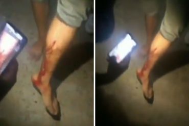 ¡LE MOSTRAMOS! “Están echando plomo”: reportaron heridos con perdigones durante disturbios en centro de votación de primarias del PSUV en el Zulia (+Video)