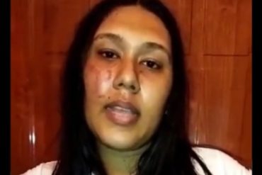 ¡VEA! “Hago un llamado al respeto, todos somos Chávez”: Así le dejaron el rostro a una activista del PSUV en Lara tras ser agredida por primarias (+Video)